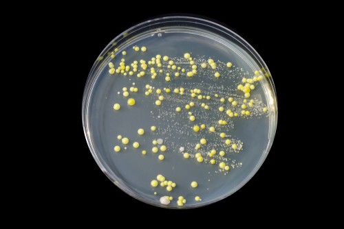 What Are The Common Bacteria In Home?